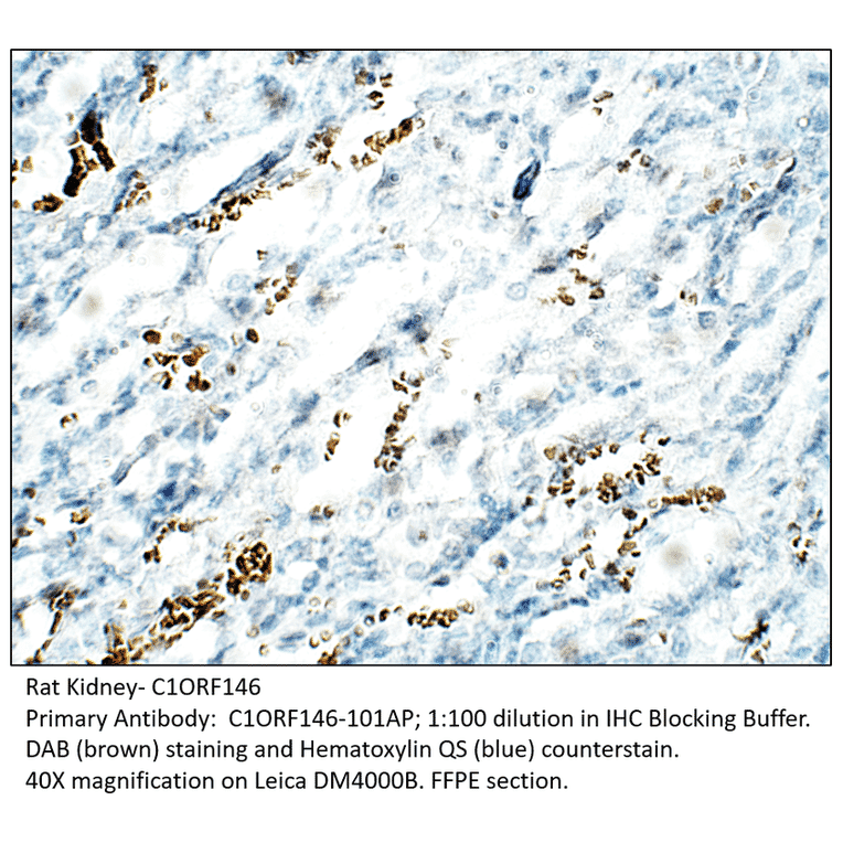 Anti-C1orf146 Antibody from FabGennix (C1ORF146-101AP) - Antibodies.com