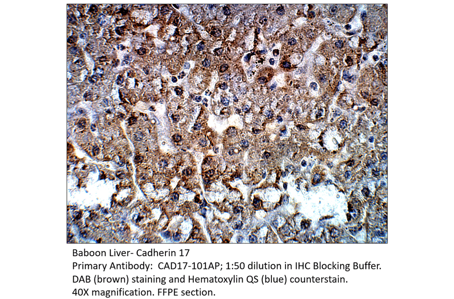 Anti-Cadherin 17 Antibody from FabGennix (CAD17-101AP) - Antibodies.com