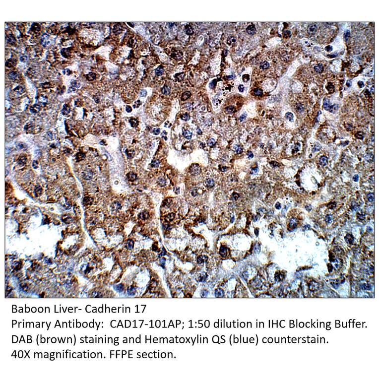 Anti-Cadherin 17 Antibody from FabGennix (CAD17-101AP) - Antibodies.com