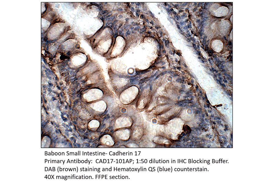 Anti-Cadherin 17 Antibody from FabGennix (CAD17-101AP) - Antibodies.com