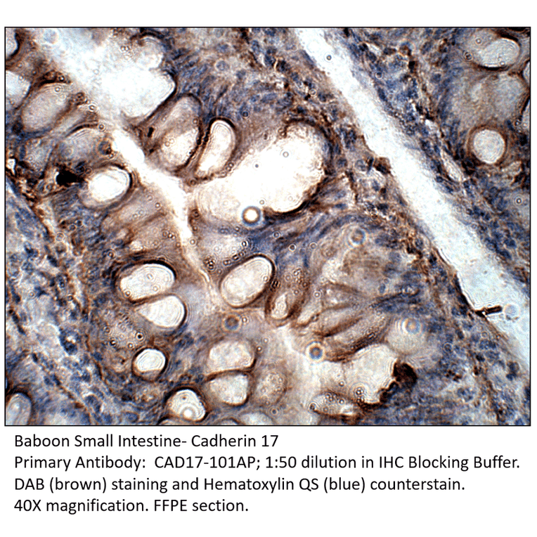 Anti-Cadherin 17 Antibody from FabGennix (CAD17-101AP) - Antibodies.com