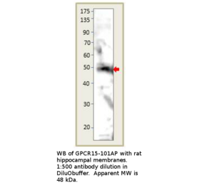 Anti-GPCR GPR15 Antibody from FabGennix (GPCR15-101AP) - Antibodies.com