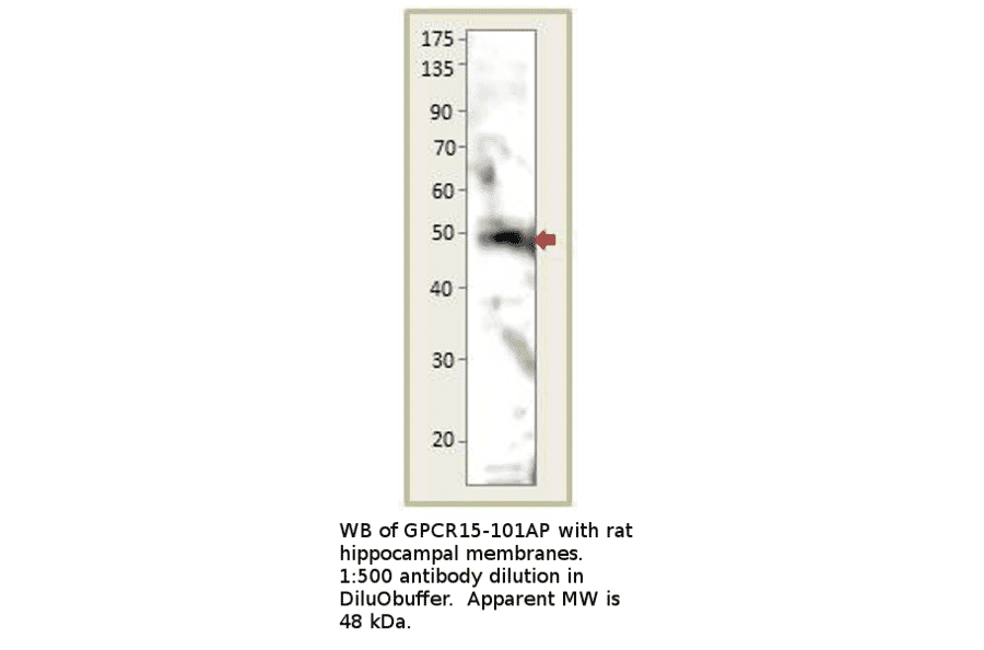 Anti-GPCR GPR15 Antibody from FabGennix (GPCR15-101AP) - Antibodies.com