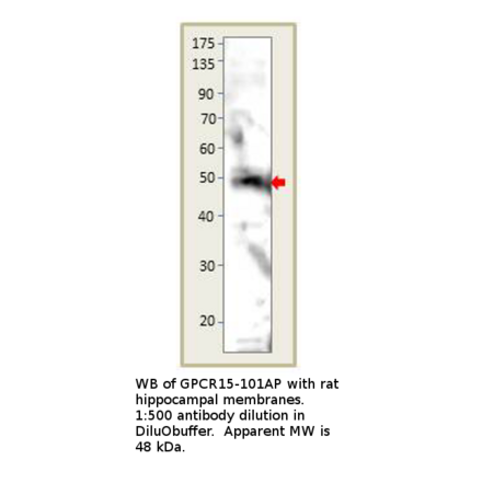 Anti-GPCR GPR15 Antibody from FabGennix (GPCR15-101AP) - Antibodies.com