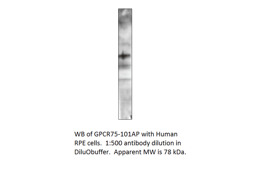 Anti-GPCR GPR75 Antibody from FabGennix (GPCR75-101AP) - Antibodies.com