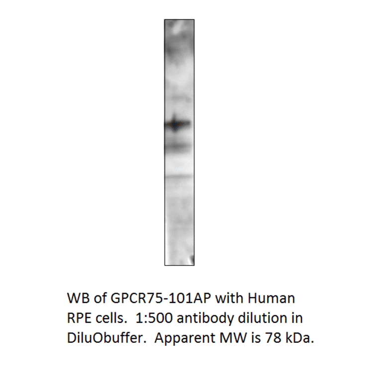 Anti-GPCR GPR75 Antibody from FabGennix (GPCR75-101AP) - Antibodies.com