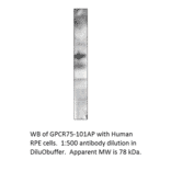 Anti-GPCR GPR75 Antibody from FabGennix (GPCR75-101AP) - Antibodies.com