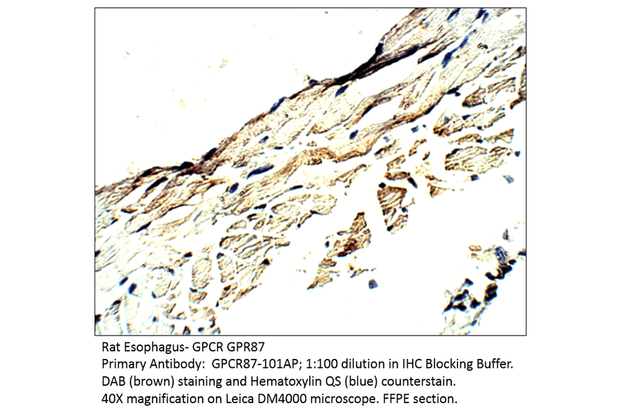 Anti-GPCR GPR87 Antibody from FabGennix (GPCR87-101AP) - Antibodies.com