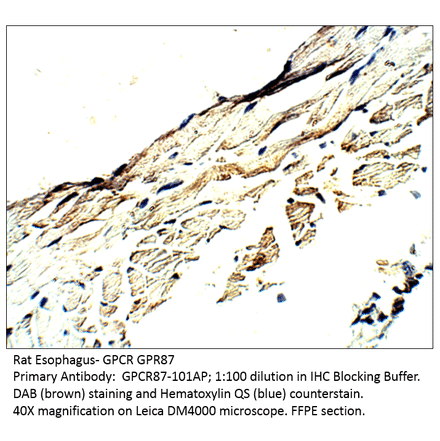 Anti-GPCR GPR87 Antibody from FabGennix (GPCR87-101AP) - Antibodies.com