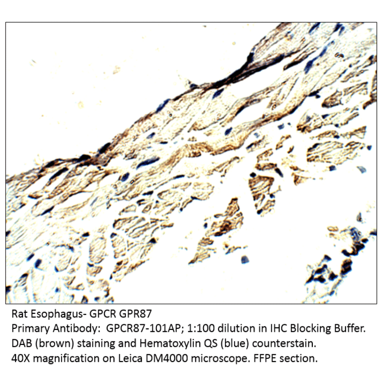 Anti-GPCR GPR87 Antibody from FabGennix (GPCR87-101AP) - Antibodies.com