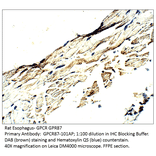 Anti-GPCR GPR87 Antibody from FabGennix (GPCR87-101AP) - Antibodies.com