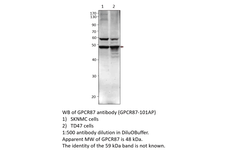Anti-GPCR GPR87 Antibody from FabGennix (GPCR87-101AP) - Antibodies.com