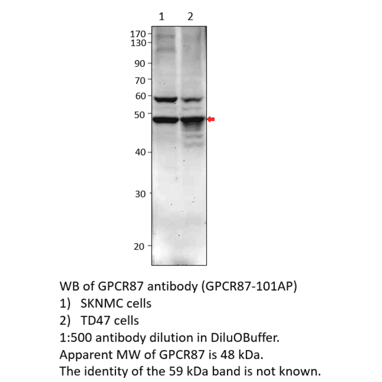Anti-GPCR GPR87 Antibody from FabGennix (GPCR87-101AP) - Antibodies.com