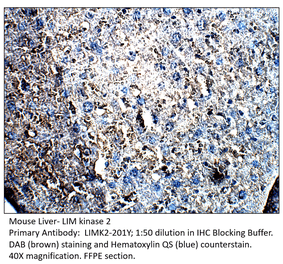 Anti-LIM kinase 2 Antibody from FabGennix (LIMK2-201Y) - Antibodies.com