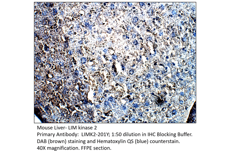 Anti-LIM kinase 2 Antibody from FabGennix (LIMK2-201Y) - Antibodies.com