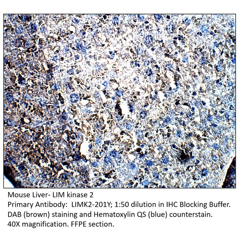 Anti-LIM kinase 2 Antibody from FabGennix (LIMK2-201Y) - Antibodies.com