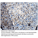 Anti-LIM kinase 2 Antibody from FabGennix (LIMK2-201Y) - Antibodies.com