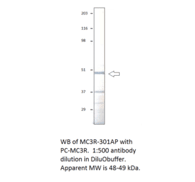 Anti-MC3 Receptor Antibody from FabGennix (MC3R-301AP) - Antibodies.com