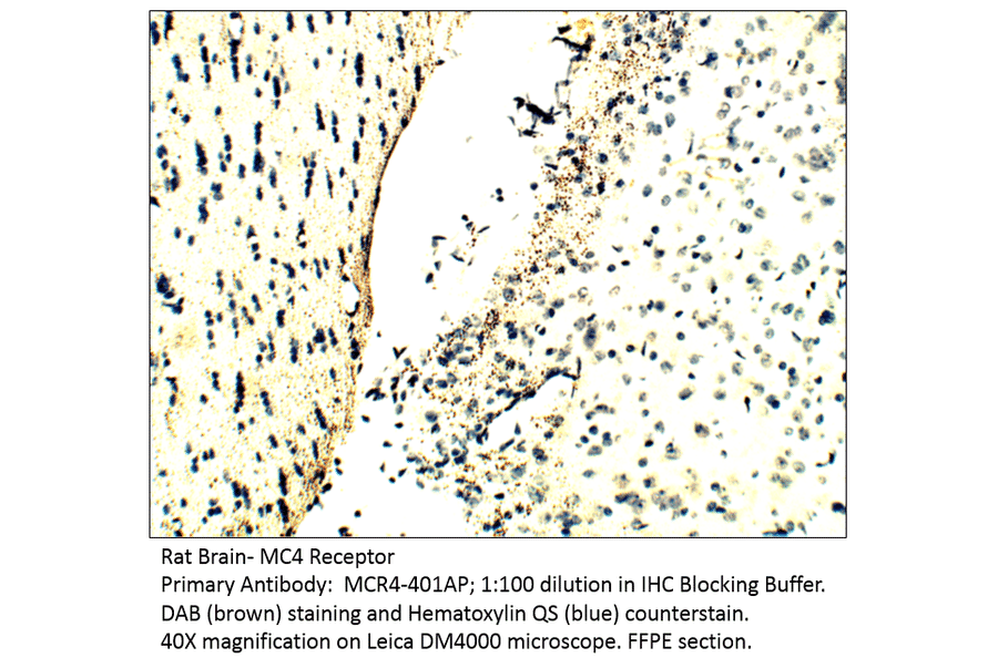 Anti-MC4 Receptor Antibody from FabGennix (MC4R-401AP) - Antibodies.com