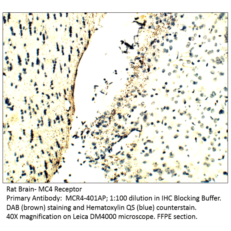 Anti-MC4 Receptor Antibody from FabGennix (MC4R-401AP) - Antibodies.com
