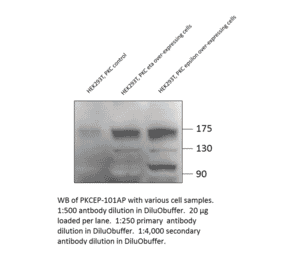 Anti-PKC epsilon Antibody from FabGennix (PKCEP-101AP) - Antibodies.com