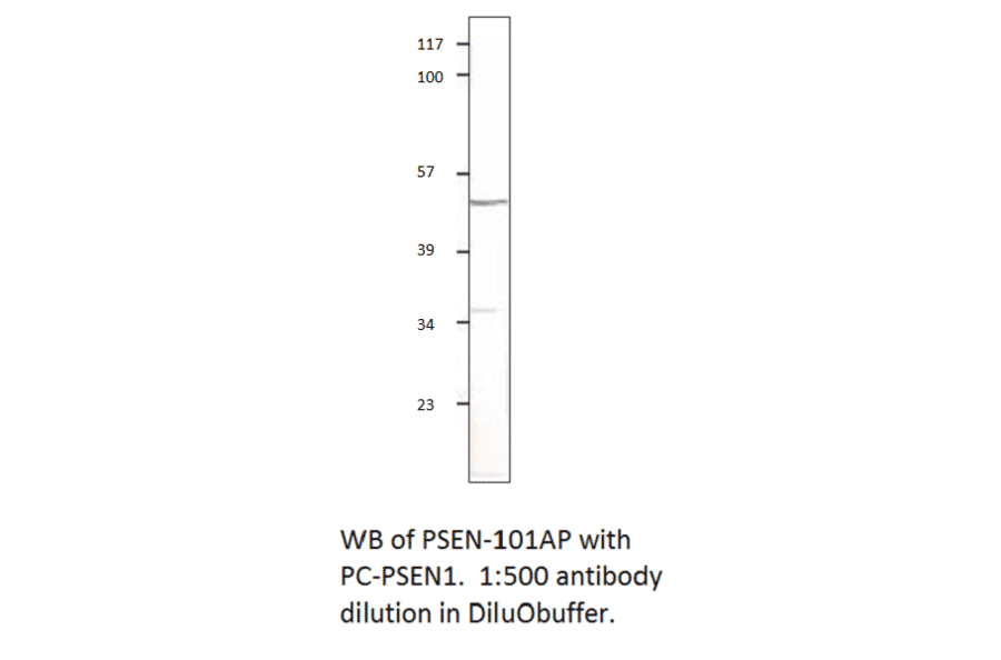 Anti-Presenilin 1 Antibody from FabGennix (PSEN-101AP) - Antibodies.com