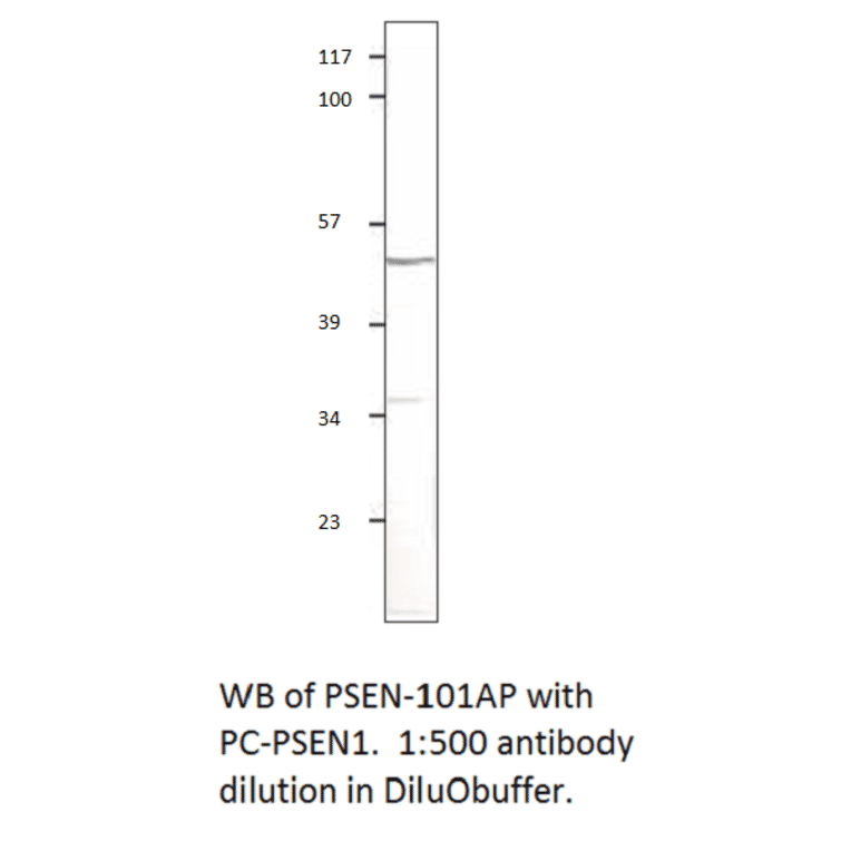 Anti-Presenilin 1 Antibody from FabGennix (PSEN-101AP) - Antibodies.com