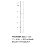 Anti-Presenilin 1 Antibody from FabGennix (PSEN-101AP) - Antibodies.com