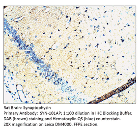 Anti-Synaptophysin Antibody from FabGennix (SYN-101AP) - Antibodies.com