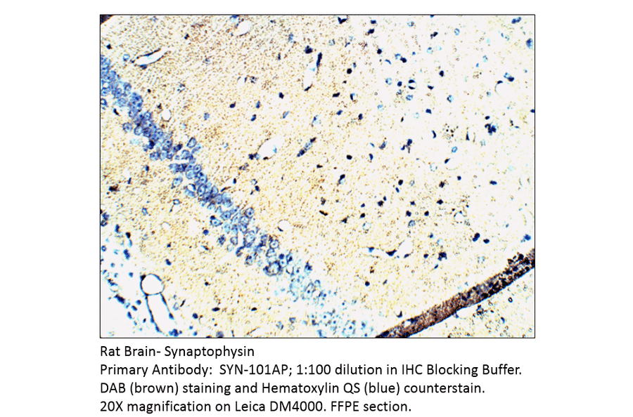 Anti-Synaptophysin Antibody from FabGennix (SYN-101AP) - Antibodies.com