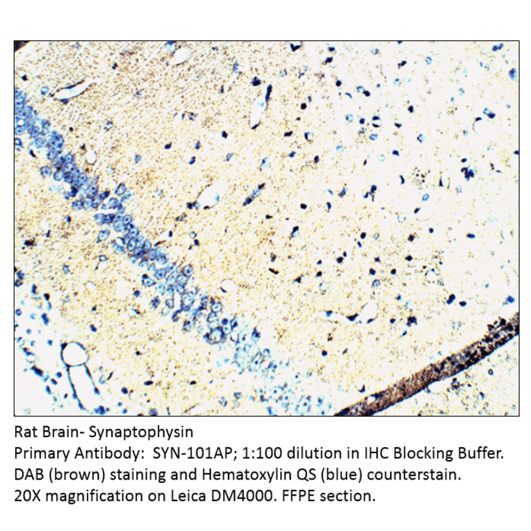 Anti-Synaptophysin Antibody from FabGennix (SYN-101AP) - Antibodies.com