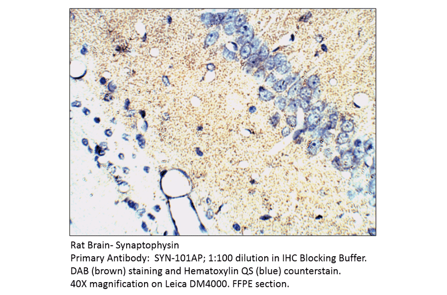 Anti-Synaptophysin Antibody from FabGennix (SYN-101AP) - Antibodies.com