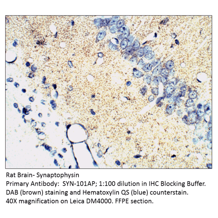 Anti-Synaptophysin Antibody from FabGennix (SYN-101AP) - Antibodies.com