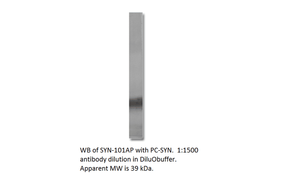 Anti-Synaptophysin Antibody from FabGennix (SYN-101AP) - Antibodies.com