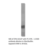 Anti-Synaptophysin Antibody from FabGennix (SYN-101AP) - Antibodies.com