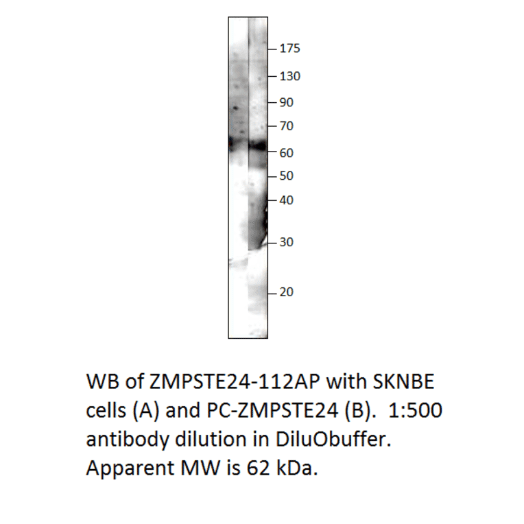 Anti-ZMPSTE24 Antibody from FabGennix (ZMPSTE24-112AP) - Antibodies.com