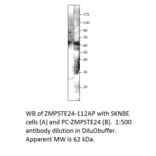 Anti-ZMPSTE24 Antibody from FabGennix (ZMPSTE24-112AP) - Antibodies.com