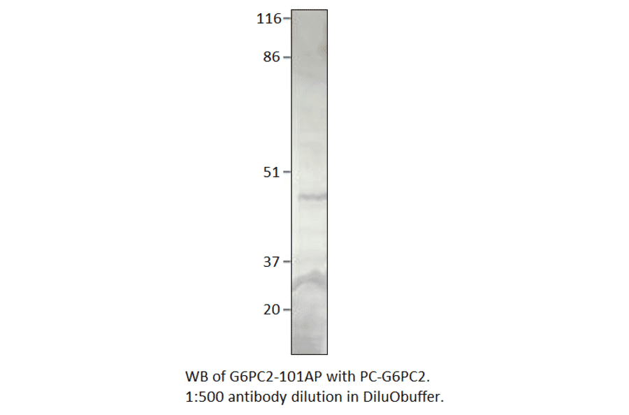Anti-Glucose-6-Phosphate, catalytic subunit Antibody from FabGennix (G6PC2-101AP) - Antibodies.com