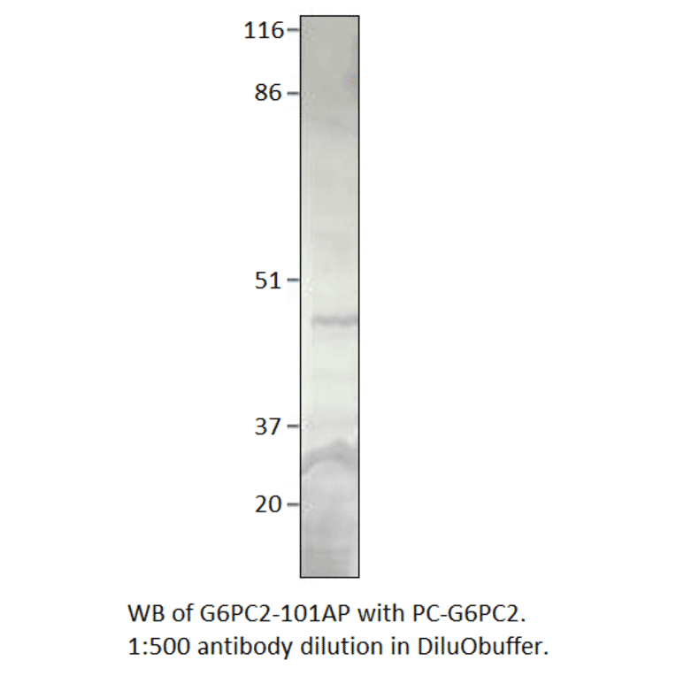 Anti-Glucose-6-Phosphate, catalytic subunit Antibody from FabGennix (G6PC2-101AP) - Antibodies.com