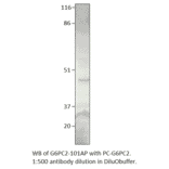 Anti-Glucose-6-Phosphate, catalytic subunit Antibody from FabGennix (G6PC2-101AP) - Antibodies.com