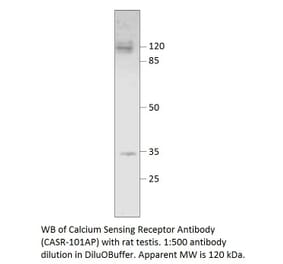 Anti-Calcium Sensing Receptor Antibody from FabGennix (CASR-101AP) - Antibodies.com