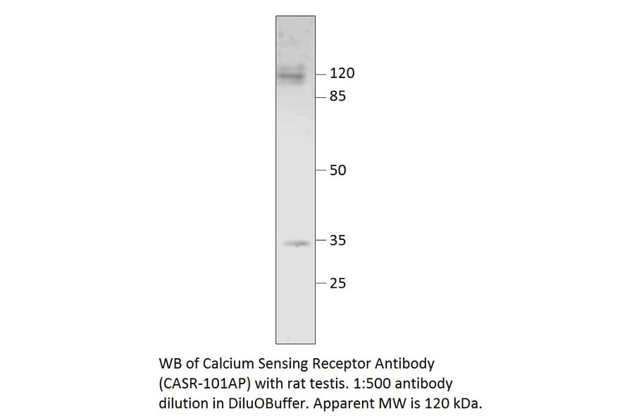 Anti-Calcium Sensing Receptor Antibody from FabGennix (CASR-101AP) - Antibodies.com