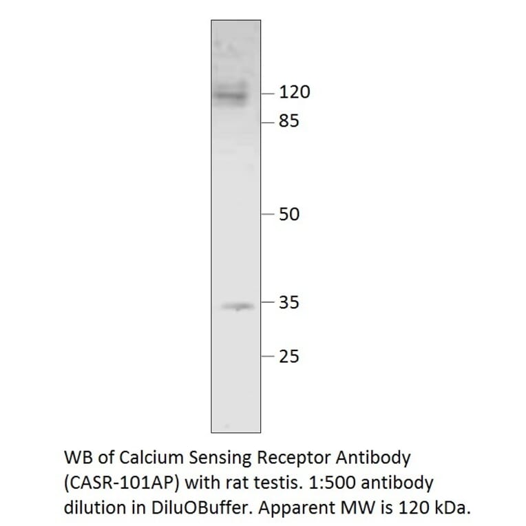 Anti-Calcium Sensing Receptor Antibody from FabGennix (CASR-101AP) - Antibodies.com