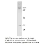 Anti-Calcium Sensing Receptor Antibody from FabGennix (CASR-101AP) - Antibodies.com