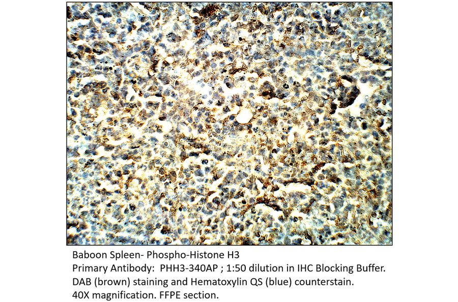 Anti-Phospho-Histone H3 Antibody (S10) from FabGennix (PHH3-340AP) - Antibodies.com