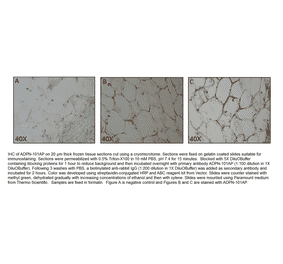 Anti-Adiponectin Antibody from FabGennix (ADPN-101AP) - Antibodies.com