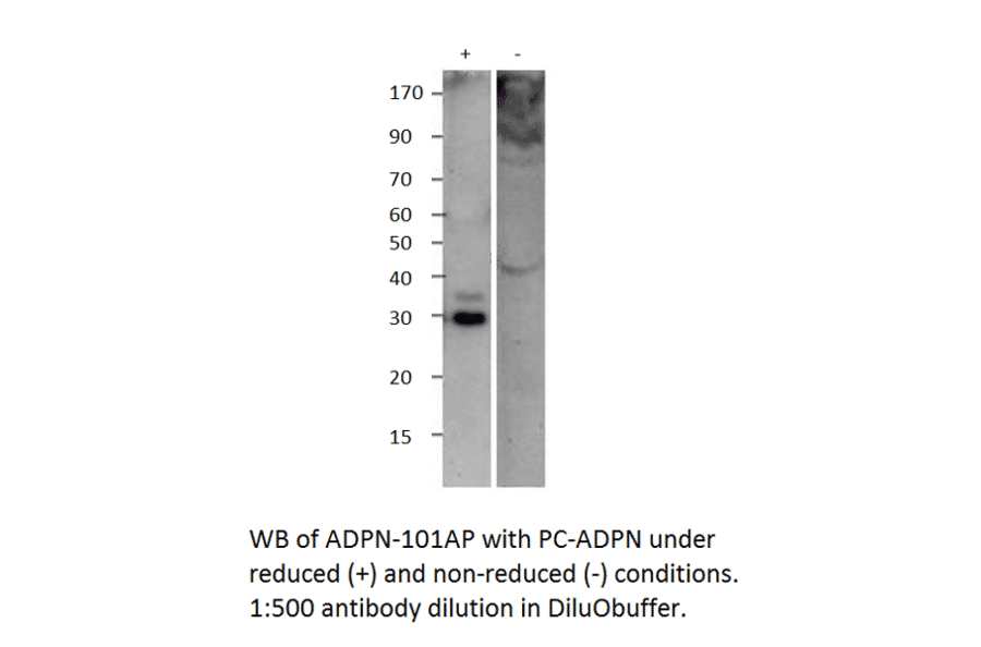 Anti-Adiponectin Antibody from FabGennix (ADPN-101AP) - Antibodies.com