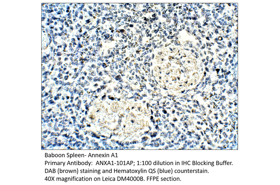 Anti-Annexin A1 Antibody from FabGennix (ANXA1-101AP) - Antibodies.com