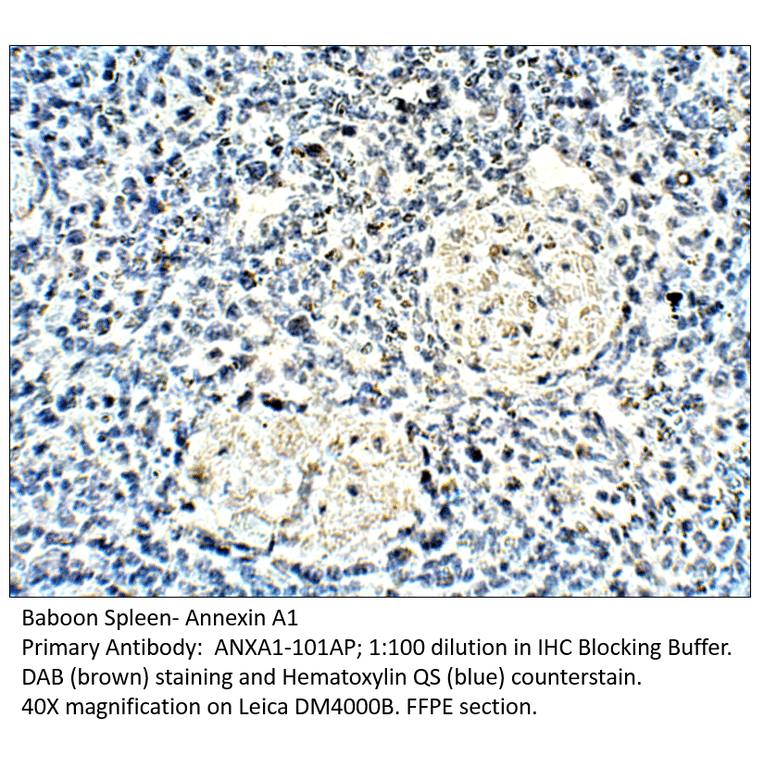 Anti-Annexin A1 Antibody from FabGennix (ANXA1-101AP) - Antibodies.com