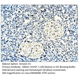 Anti-Annexin A1 Antibody from FabGennix (ANXA1-101AP) - Antibodies.com